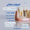 کاشت ایمپلنت بدون فشار مالی با اقساط بلند مدت