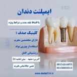 کاشت ایمپلنت بدون فشار مالی با اقساط بلند مدت