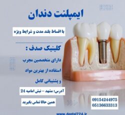 کاشت ایمپلنت بدون فشار مالی با اقساط بلند مدت