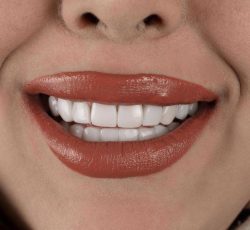 کلینیک دندانپزشکی لیدو