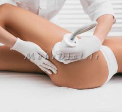 مشاور رژیم غذایی گیاه خواری