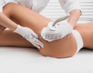مشاور رژیم غذایی گیاه خواری