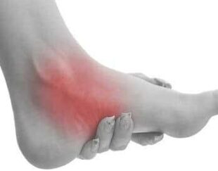 اسکن کف پا در غرب تهران