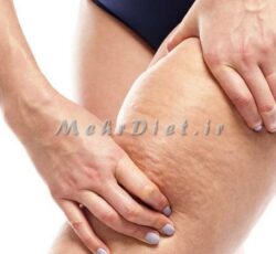 ‏‎رژیم درمانی ورزشی کبد چرب پونک