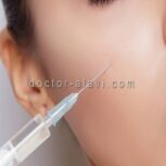 تزریق ژل گونه هفت حوض