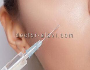 تزریق ژل گونه هفت حوض