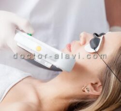 ‏‎تزریق بوتاکس کف دست