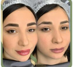 فیبروز ابرو در مرکز میکروبلیدینگ غزل زرگریان