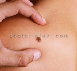 ‎پاکسازی پوست صورت