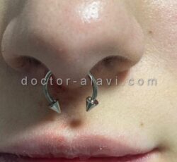 ‎جوانسازی پوست صورت