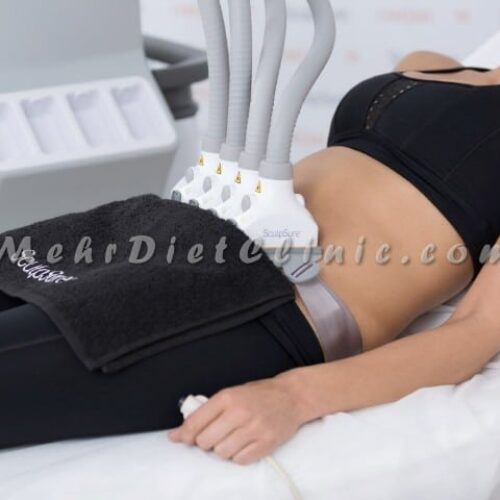 دستگاه لاغری کرایو اسکالپشور