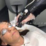 دستگاه لیزر مو های زائد سایناشور آمریکا