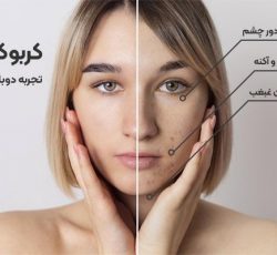 خدمات مزوتراپی در گرگان