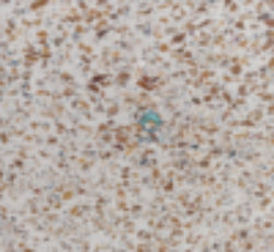 موزاییک مرمر سنگ ریز نمره 2 با تراکم سنگ بالا